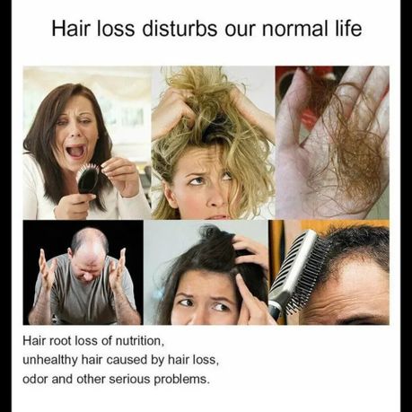 Biotin Hair Shampoo