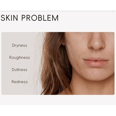 Snail Essence Skin Care Kit