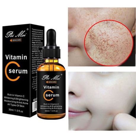 Face Serum Set: Vitamin C, Hyaluronic Acid & Retinol with Cosmetic Bag