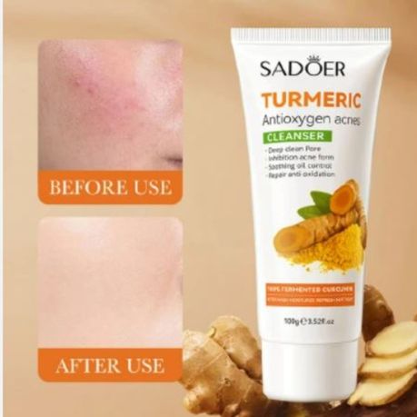 Tumeric Antioxygen Repair Facial Set- Cleanser, Toner, Lotion Serum& Cream