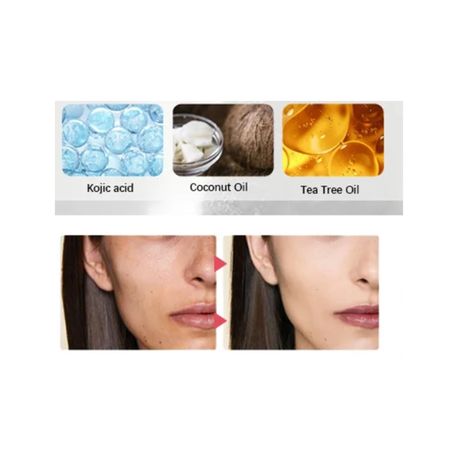Kojic Acid Skincare Soap - 6 Pack